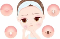 去痘印痘坑做什么醫(yī)美？常見(jiàn)醫(yī)美項(xiàng)目組合方案和大致價(jià)格區(qū)間整理