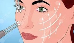 微拉美面部提升可以保持多久？效果衰減過(guò)程、補(bǔ)做頻率以及如何延長(zhǎng)維持期解析