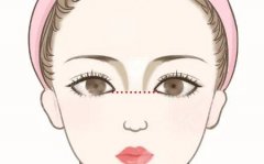 墊鼻梁的危害有多大？這些隱形危害90%的人都沒(méi)摸清，趕緊看