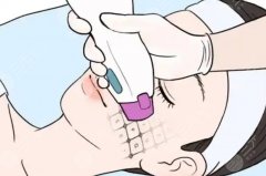 南京哪里做熱瑪吉比較好？怎么選機(jī)構(gòu)不踩雷，面診必問問題都整理了