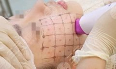 臨沂熱瑪吉哪里好？當(dāng)?shù)乜诒駟谓視裕x對了才是真的值