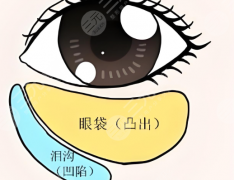 長治哪個醫(yī)院做眼袋好？口碑好的醫(yī)院有五家