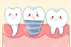 威海中諾口腔種植牙怎么樣？多少錢(qián)？?jī)r(jià)格透明嗎，看完這篇心里有數(shù)
