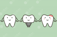 北海嘉霖同步口腔種植牙怎么樣？多少錢(qián)？做種植牙值不值得看這一篇就夠了