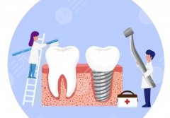 廣州暨廣口腔種植牙怎么樣？多少錢(qián)？本地種種牙價(jià)格參考附暨廣的收費(fèi)對(duì)比