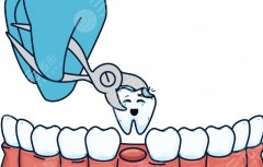 廣州團(tuán)圓口腔種植牙怎么樣？多少錢(qián)？?jī)r(jià)格高不高、醫(yī)生穩(wěn)不穩(wěn)先看這一篇