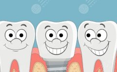 濟南眾牙口腔種植牙怎么樣？多少錢？項目評價和收費標準一并盤點