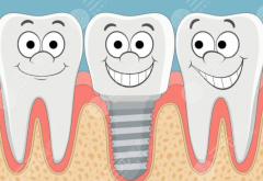 楚雄檸檬口腔種植牙怎么樣？多少錢？口碑如何、價格貴不貴速覽