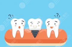 南京茀萊堡口腔種植牙怎么樣？多少錢？種植方向和費用明細同步盤點