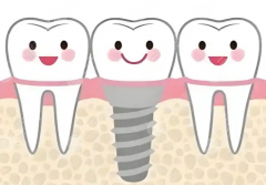 德州可恩口腔醫(yī)院種植牙怎么樣？多少錢？從品牌背景到種牙收費，看完再決定要不要去