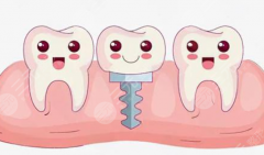 東莞牙狀元口腔種植牙怎么樣？多少錢？院內(nèi)熱門種植項目、價格區(qū)間和醫(yī)生特色一文看明白