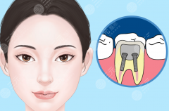 惠州皓齒口腔種植牙怎么樣？多少錢？一顆牙背后包含哪些費用