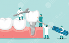 中山暨博口腔種植牙怎么樣？多少錢？收費貴不貴、種一顆牙多少錢速看