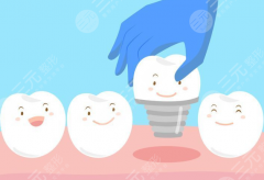 平湖市麥芽口腔種植牙怎么樣？多少錢？機(jī)構(gòu)實力、種植技術(shù)和價格參考一篇看懂