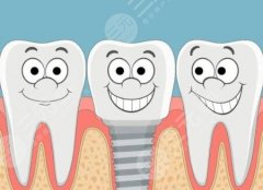 珠海香洲綠荷口腔種植牙怎么樣？多少錢(qián)？2026新實(shí)測(cè)攻略速看