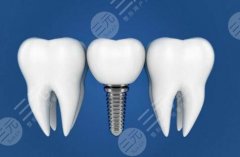 成都郫都包世洲口腔種植牙怎么樣？多少錢？全解析：價(jià)格、資質(zhì)、服務(wù)了解