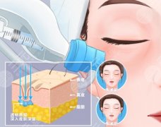 南昌大學(xué)第一附屬醫(yī)院除皺多少錢？一般8958元左右！價(jià)格表參考！