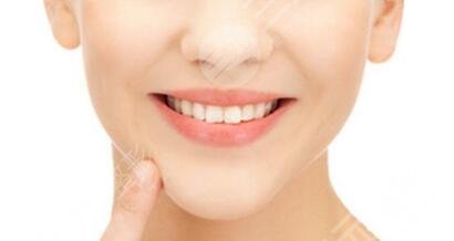 自體脂肪豐下巴前后對比明X嗎？自體脂肪豐下巴案例果