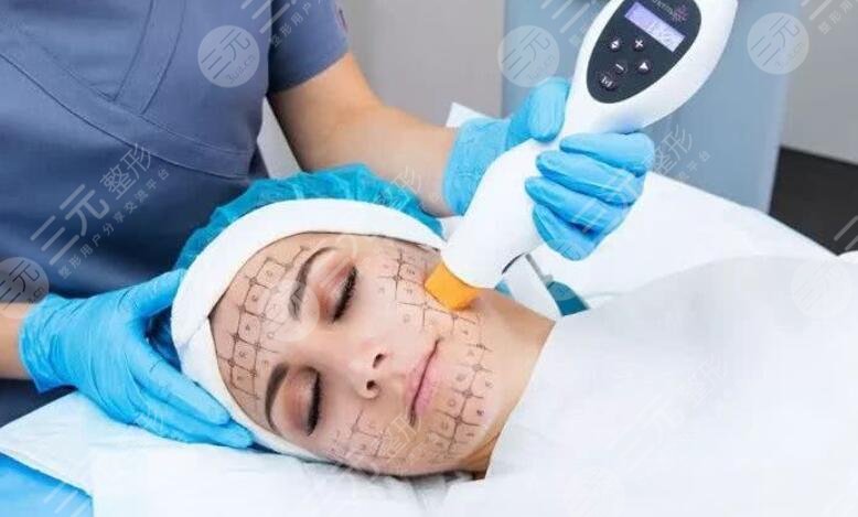 先做超聲提拉還是先做熱瑪吉比較好？專(zhuān)業(yè)人士告訴你怎么選！