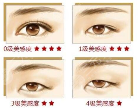 開(kāi)眼角雙眼皮失敗重慶當(dāng)代整形醫(yī)院能修復(fù)嗎