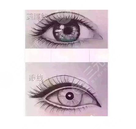 紋眼線多久能恢復(fù)