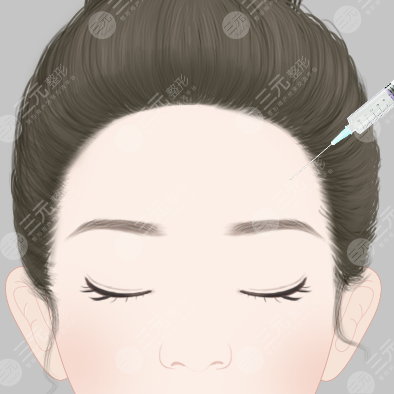 自體脂肪面部填充后臉會顯大嗎