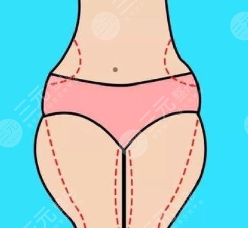 針灸減肥應該注意些什么？針灸降低風險與否？針灸減肥如何選擇醫(yī)院？