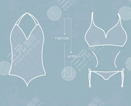 吸脂去眼袋果怎么樣