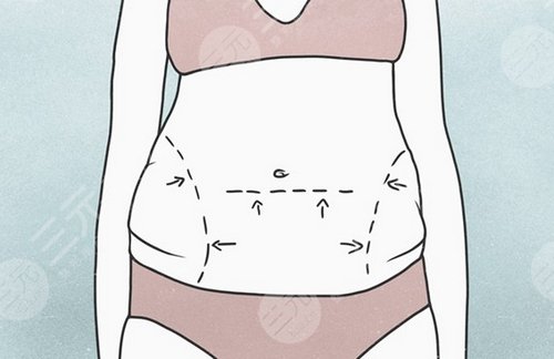 身體吸脂的價格是多少