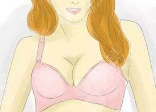 自體脂肪豐胸多久沒硬塊