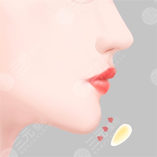 有雙下巴怎么辦？減掉雙下巴的小訣竅