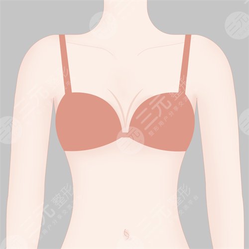 手臂塑形吸脂減肥果好不好?