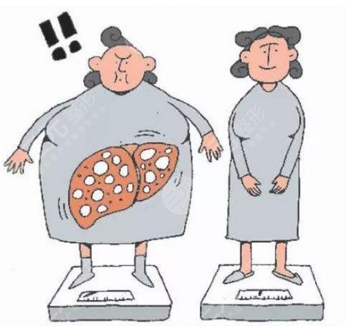 怎么樣溶脂減肥的果比較好？溶脂吸脂減肥的注意事項有哪些？