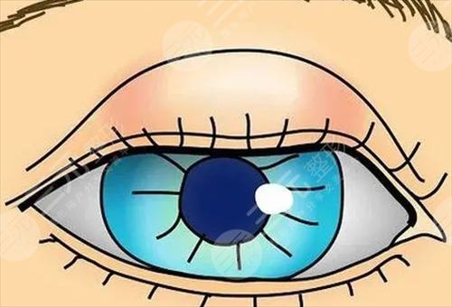 孕睫術(shù)要多少錢(qián)？有什么危害嗎？